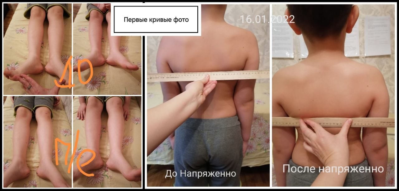 Материал кейса БВТ