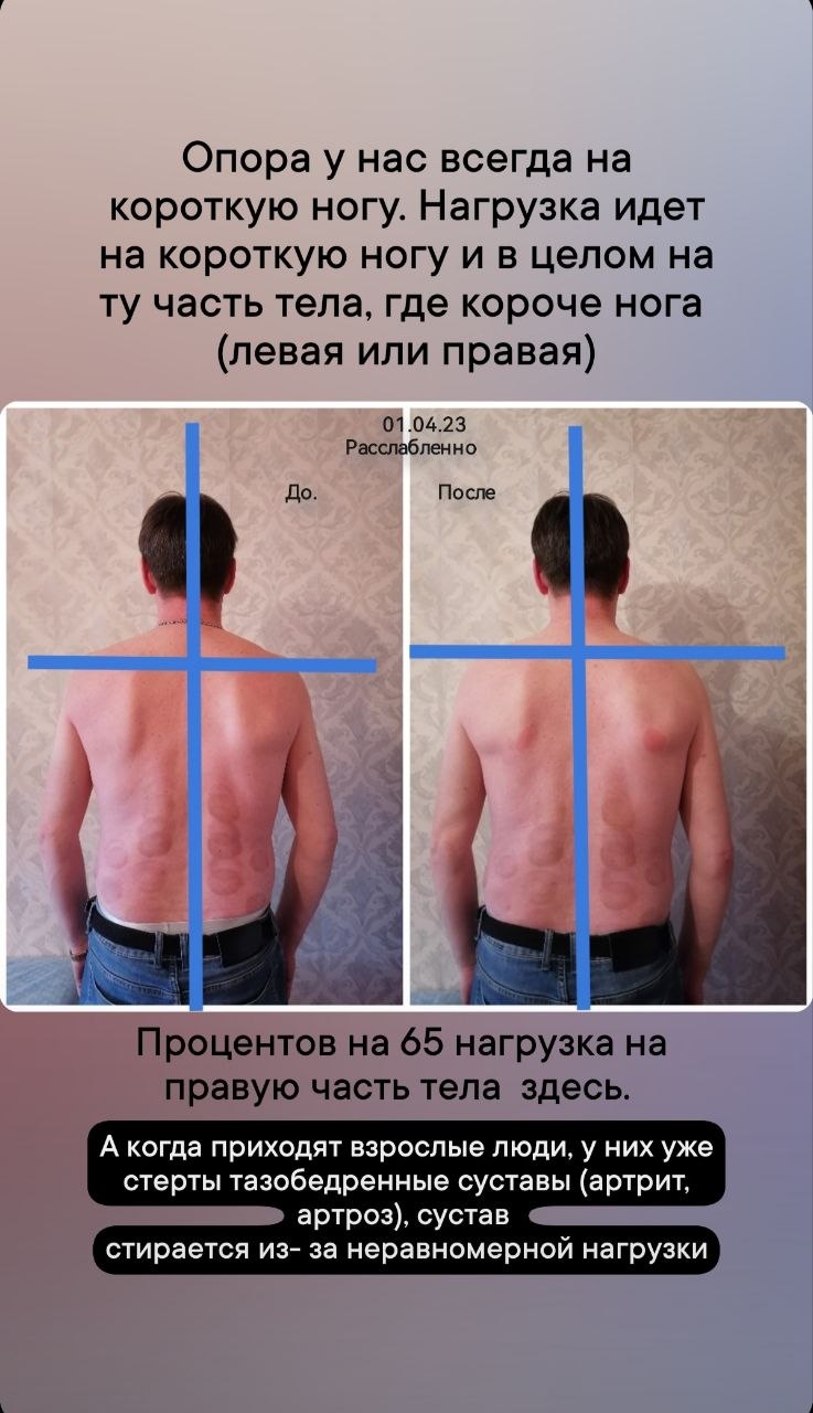Материал кейса БВТ