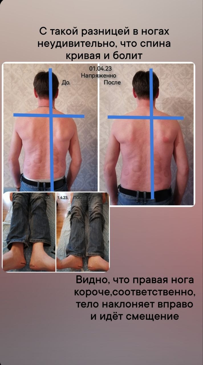 Материал кейса БВТ